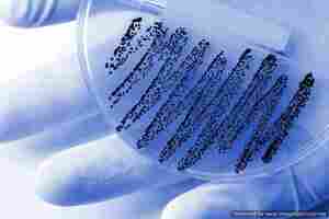 £10m research competition to tackle antimicrobial resistance 