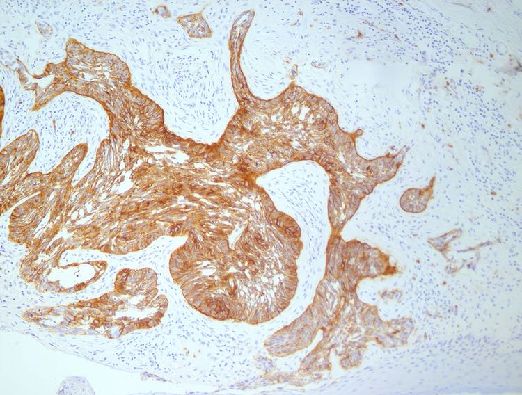 4D pharma receives expedited acceptance for COVID-19 immunomodulatory therapy