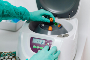 AbbVie and Gedeon Richter join forces to advance neuropsychiatric target R&D
