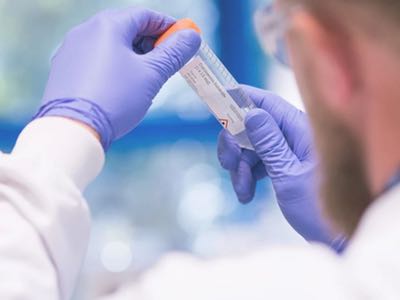 Abcam acquires Calico Biolabs