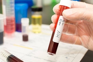 ABIVAX’s ABX464 reduces HIV reservoir in blood in second phase clinical trial