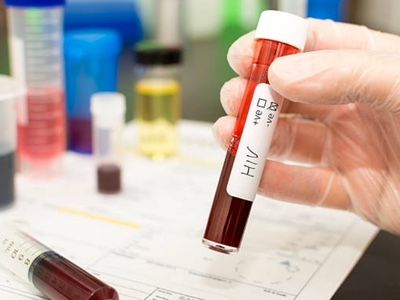 ABIVAX’s ABX464 reduces HIV reservoir in blood in second phase clinical trial