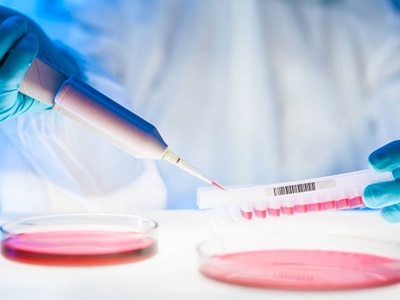 Abzena and UGA Biopharma collaborate to treat MS