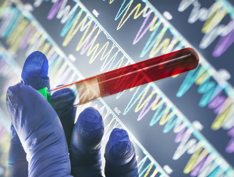 Academic Medical Center develops COVID-19 plasma treatment