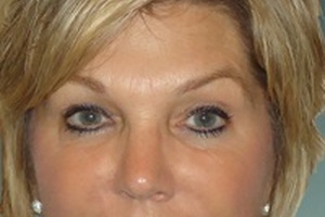 ACR Image Metrix hires Kathy Freeman