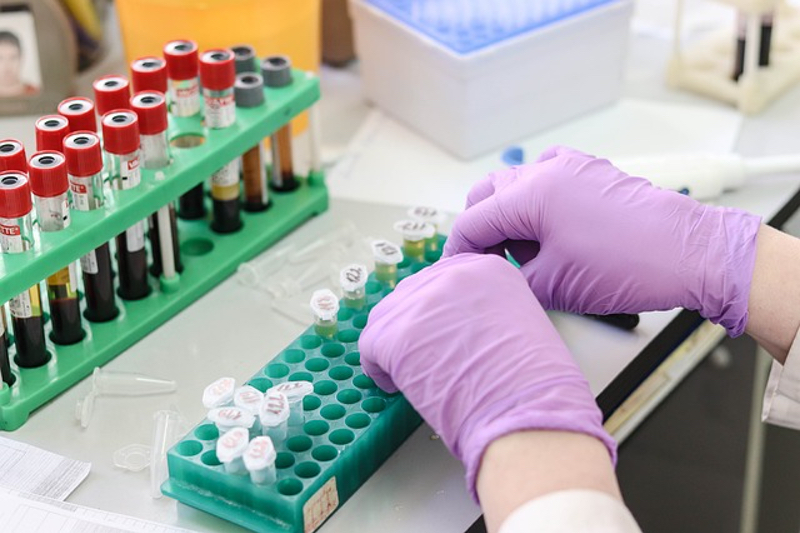 Agarose Bead Technologies expands its Spanish agarose resin manufacturing facility