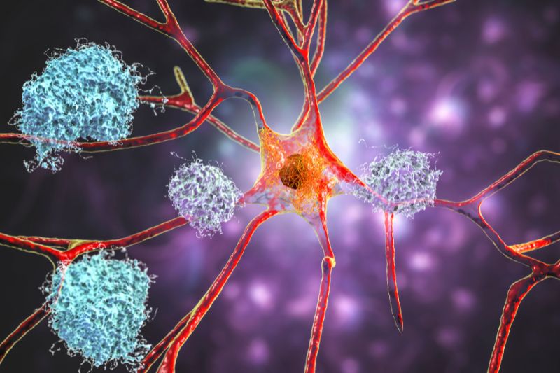 Akeso wins NMPA approval to trial first China-developed bispecific Alzheimer’s antibody