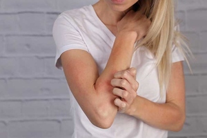 Almirall looks to raise awareness about atopic eczema