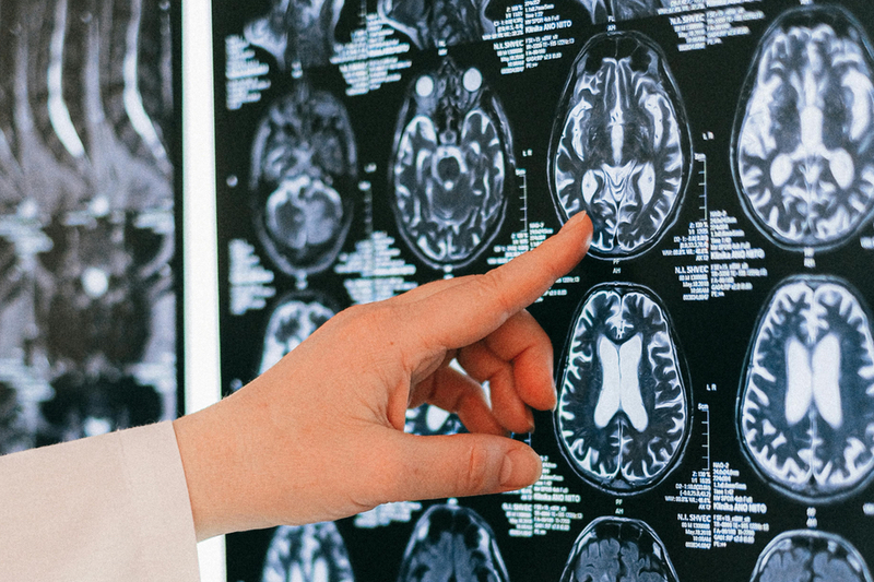 Alzheimer's drug lecanemab deemed unsuitable for the UK NHS by health regulator