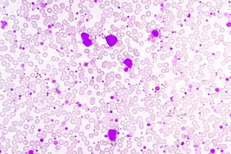 Amphista Therapeutics nominates first clinical candidate AMX-883, a novel Targeted Glue degrader for acute myeloid leukaemia