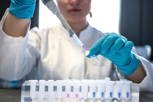Andelyn Biosciences to manufacture AAV vectors for UMass Chan Medical School to treat cockayne syndrome