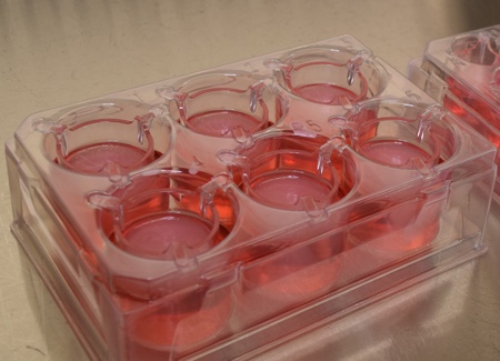 Animal-free approach to metabolism studies