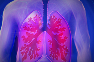 APAC non-small cell lung cancer market to double