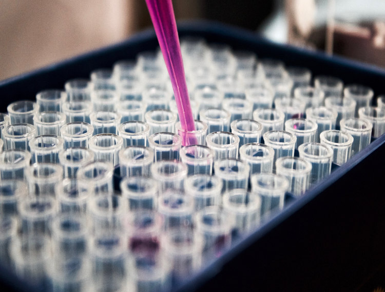 Aptamer and Bio-Works collaborate on gene therapy scale up project 