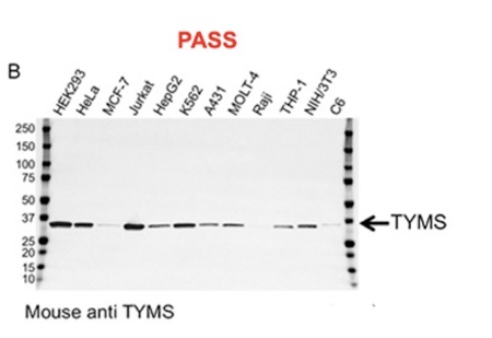 Validation data for two antibodies. A, this carbonic anhydrase IX (CA9) mouse monoclonal antibody failed validation due to nonspecific binding and low signal-to-noise ratio; B, this thymidylate synthase (TYMS) mouse monoclonal antibody passed validation showing high specificity and sensitivity.