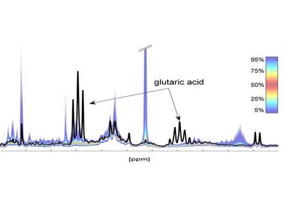 1 hour NMR spectrum of urine