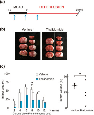 The effect of thalidomide on infarct volume of the MCAO/R model