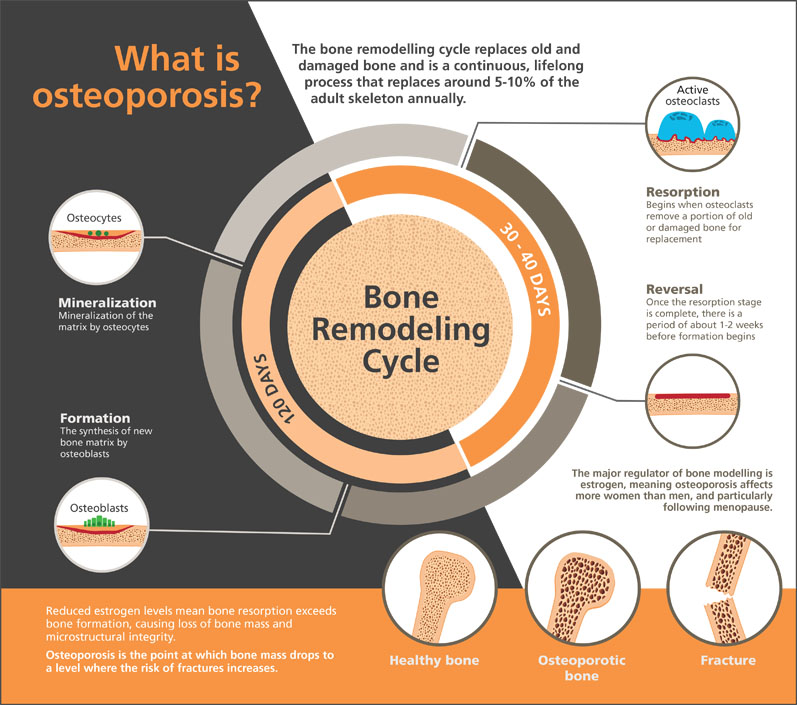 Figure 1: Osteoporosis and the bone remodelling cycle