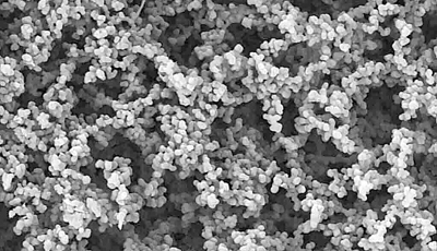 Fig. 3: The Mustang Q unit uses a membrane whose large internal surface area offers a high dynamic capacity for large biomolecules compared with conventional beads with diffusive pores