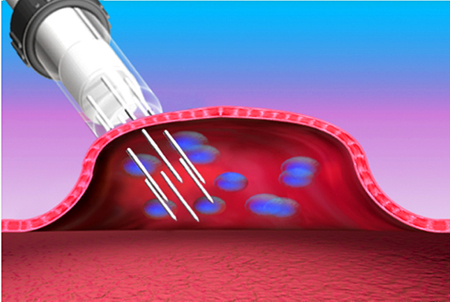 Tissue electroporation enhances cellular uptake