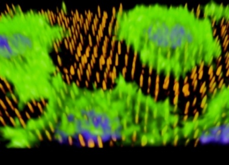 The image shows human cells (green) on the nanoneedles (orange). The nanoneedles have injected DNA into the cells’ nuclei (blue). The image was taken by the researchers using optical microscopy. Photo credit: Imperial College London