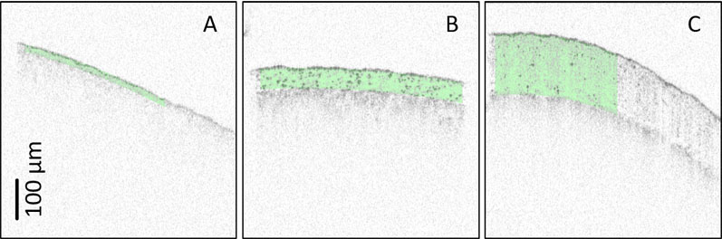 Figure 3: OCT images of commercial tablets acquired inline: (A) = HPMC-based cosmetic coating; (B) = Eudragit-based delayed release coating; and (C) = HPMC/cellulose acetate-based controlled osmotic release coating