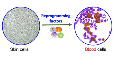 Making blood from skin cells through direct reprogramming. 
