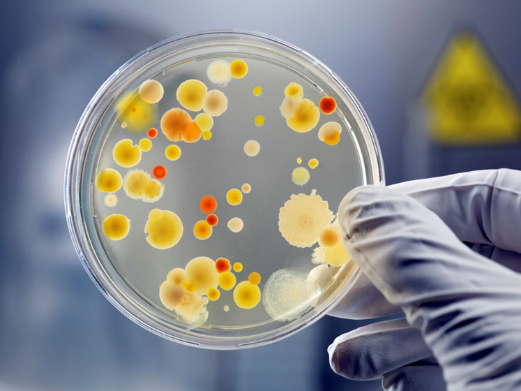 Taking a multifaceted approach to combatting superbugs
