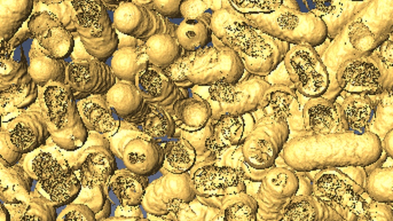 A 3D rendering shows dead bacteria and where it has been eaten by the nanozymes. Photo: Dr Chaitali Dekiwadia/ RMIT Microscopy and Microanalysis Facility  