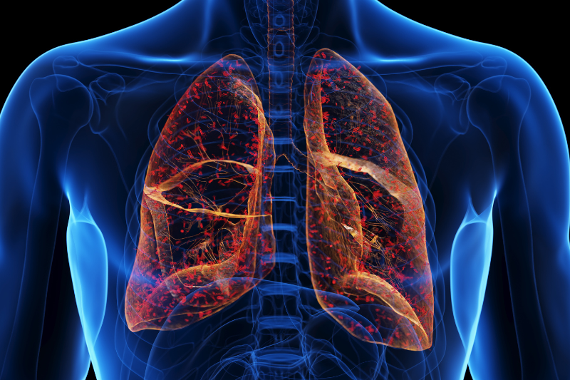 AstraZeneca's tozorakimab succeeds in third pivotal Phase III COPD trial