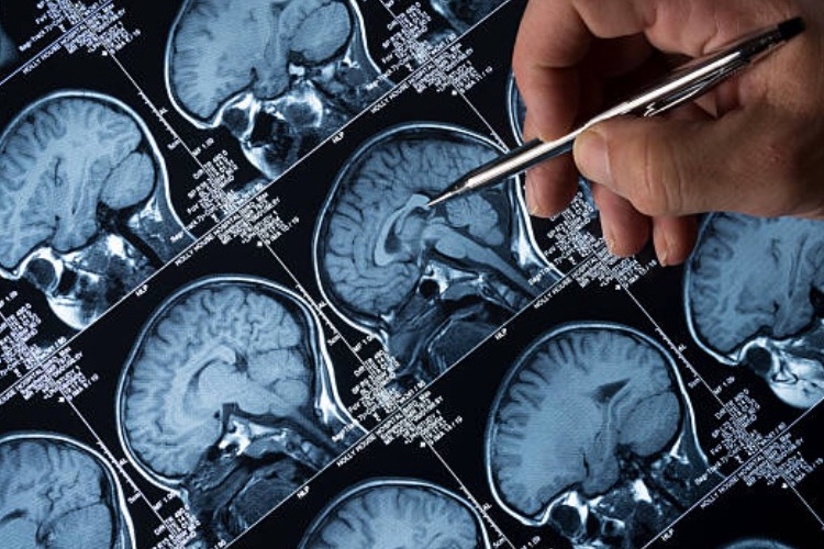 At the frontier of brain tumour research, leave no stone unturned