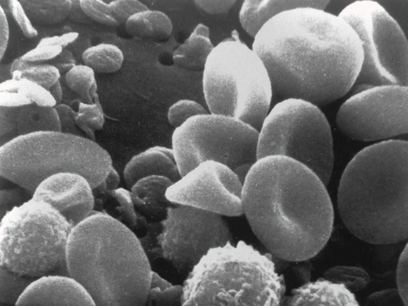 Avectas, CCRM and Omniabio to develop stem cells