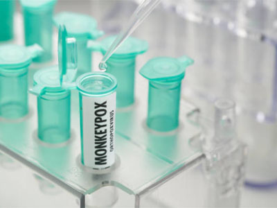 Bavarian Nordic enters first large vaccine contract for monkeypox outbreak