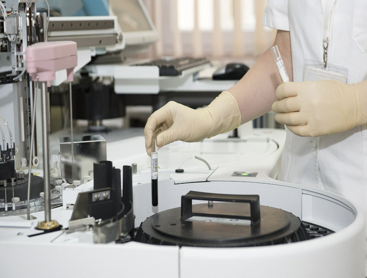 BD and CerTest Biotec announce test for COVID-19 variants