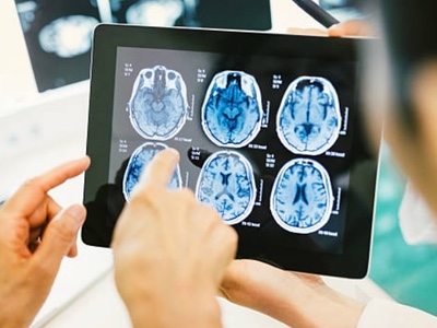 Beactica awarded funding to develop therapeutics against brain tumours