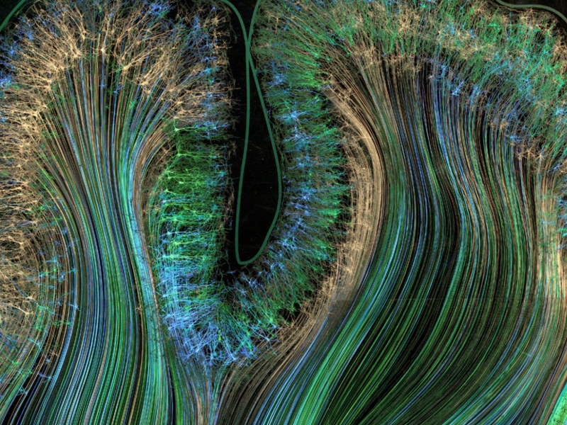 Beckley Psytech receives FDA approval for short-acting psychedelic