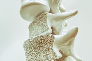 Biocon Biologics wins FDA approval for Bosaya and Aukelso, denosumab biosimilars to Prolia and Xgeva