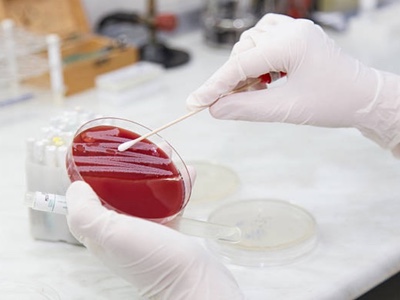 Biotech required to combat antibiotic apocalypse