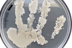 Birmingham University develops new antimicrobial coating