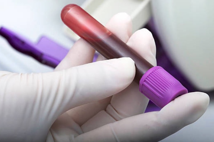 Blood test could predict response to new breast cancer treatment