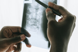 Bone Therapeutics refocuses on lead clinical asset