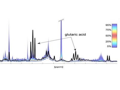 Bruker announced novel NMR phenomics research capabilities