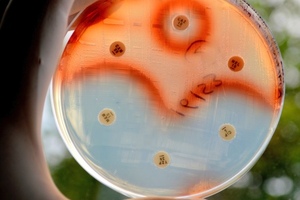 Can new discoveries prevent an antibiotic Armageddon?