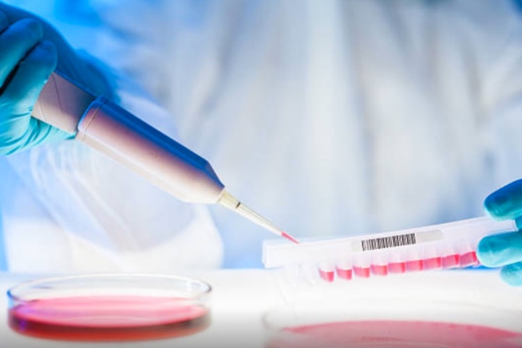 Catalent Biologics adopts Berkeley Lights’ Beacon optofluidic platform 