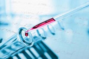 CatSci expands focus to lead optimisation