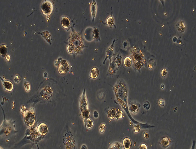 Cell Guidance Systems tech restores healthy macrophage activity