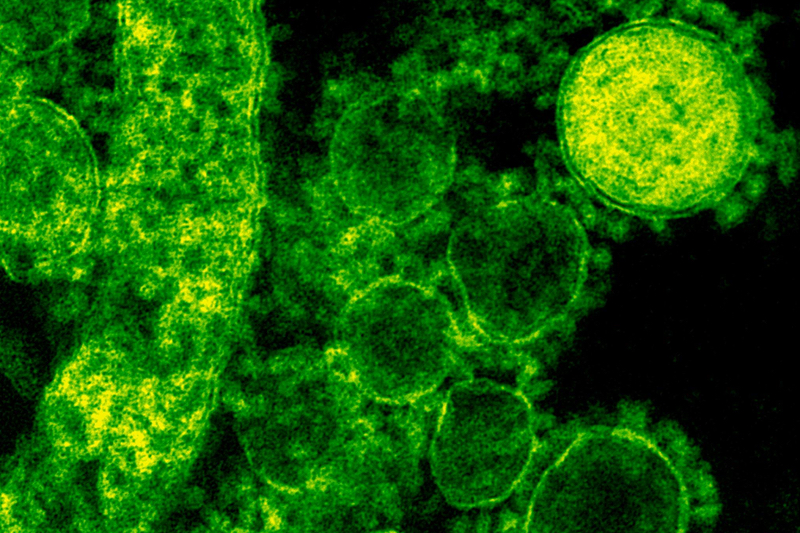 Cellevate secures €3.2m to commercialise nanofibre microcarriers for CGTs