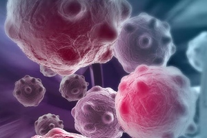 Cesca Therapeutics changes name to match new focus