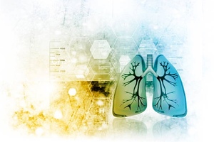 Circassia receives Innovative Technology contract from Vizient