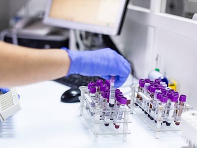 Clearbridge BioMedics joins CANCER-ID consortium 